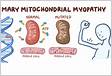 Diagnosis and Treatment of Mitochondrial Myopathies
